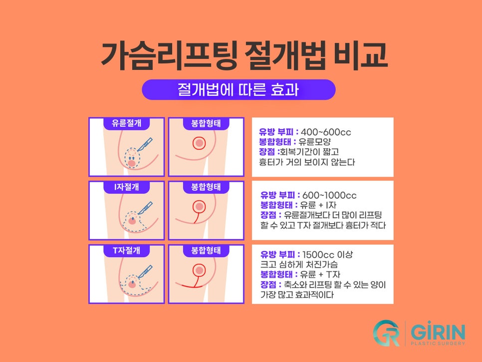 가슴처짐수술 교정으로 자신감 찾아 관련 이미지 7