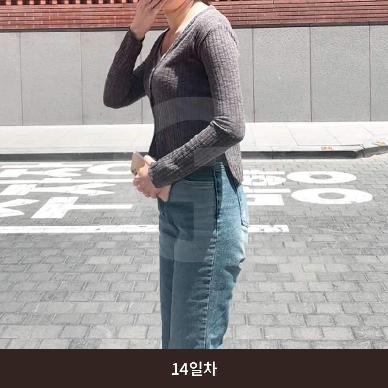 요가로 소용없던 굵은 팔뚝 지방흡입 수술 후기 관련 이미지 11