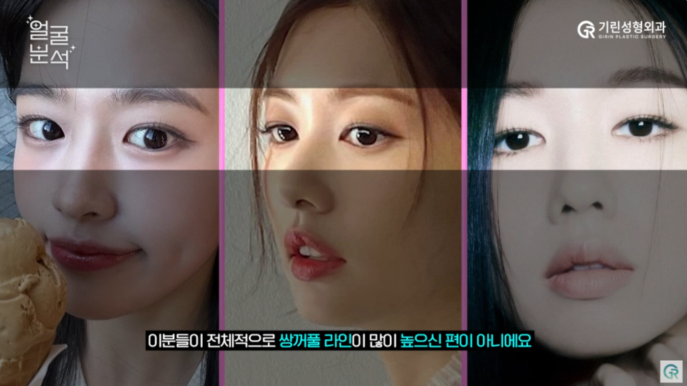 [기린성형외과의원]_자매 아닌가요? 안유진, 정소민, 안은진 얼굴분석 관련 이미지 5