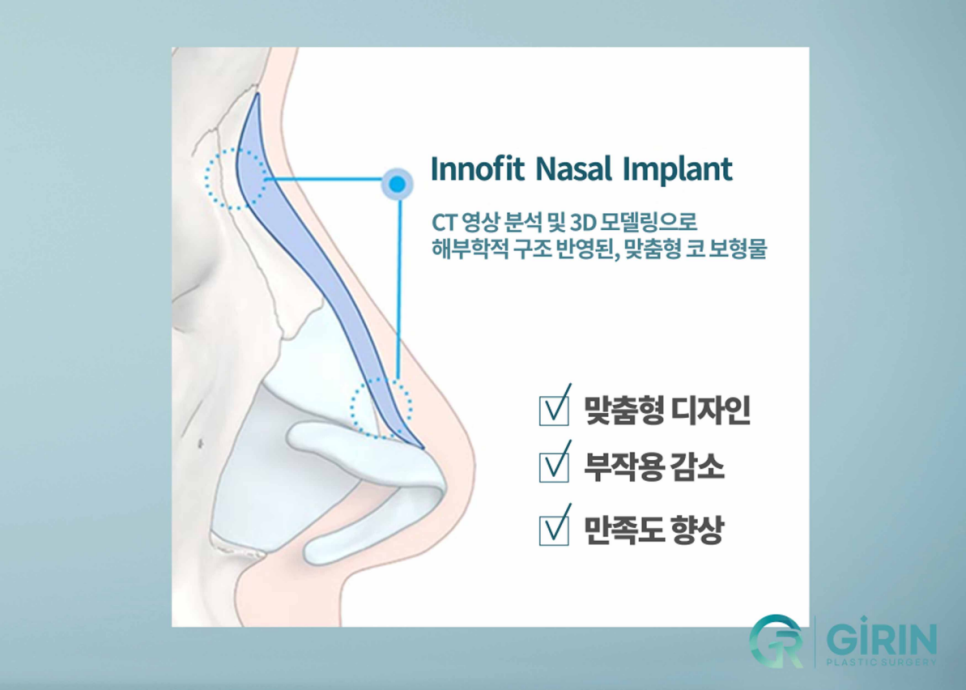 낮은코수술 눈에 보이는 차이를 원한다면 관련 이미지 11
