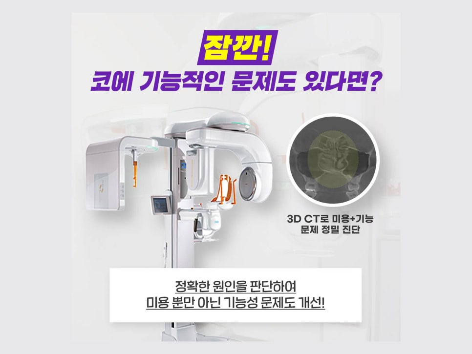 비절개콧볼축소수술 자연스럽고 예쁜 코 만들기 관련 이미지 5