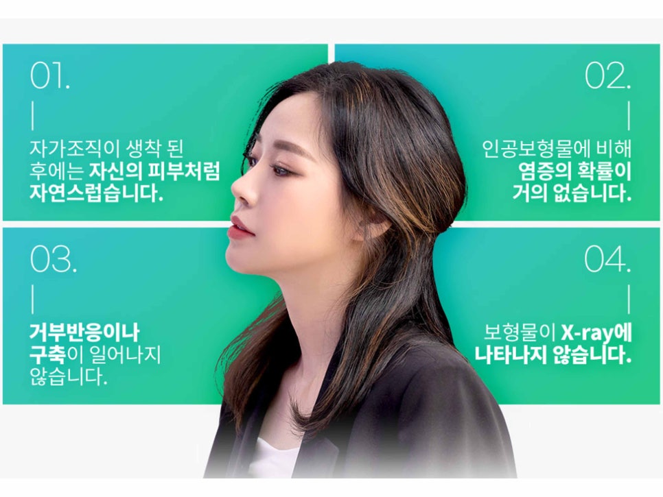 강남역성형외과유명한곳 얼굴에 맞춰 조화롭게 관련 이미지 7