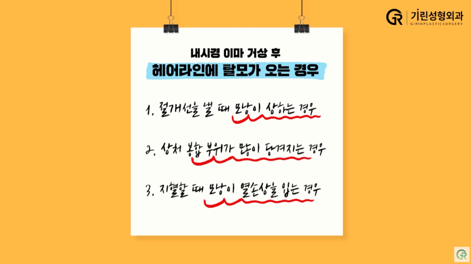 [기린성형외과] 어제보다 오늘 더 젊어지는 기린 이마거상_이마거상 Q&A 관련 이미지 14