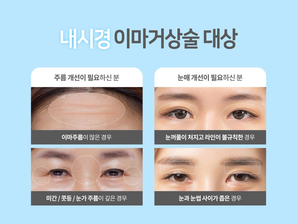 이마거상술 미리 확인해야 할 부분은? 관련 이미지 4