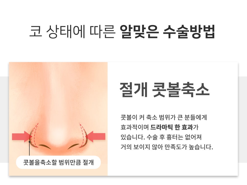 복코수술전후 이미지가 달라지는 관련 이미지 7