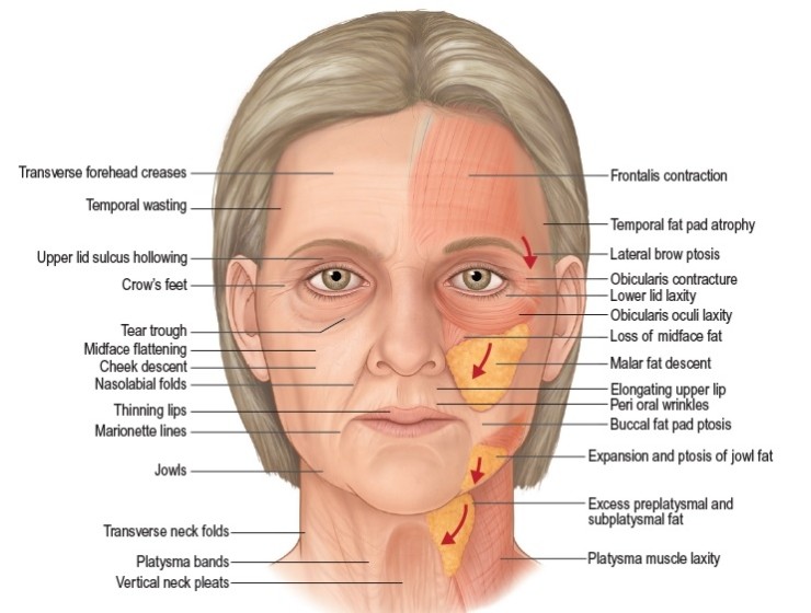 [공유] 안면거상술 고민중이시라면 꼭 읽어보세요! 안면거상술 어떤 분들에게 필요하고, 어떤 효과가 있는 수술인가? 관련 이미지 7