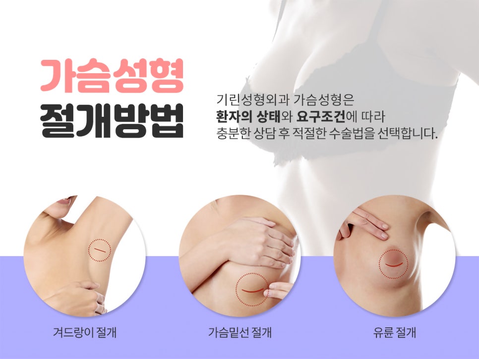서울가슴성형 볼륨감 차이를 위해 관련 이미지 11