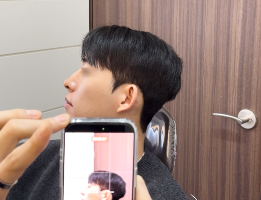 남자 미니젤리코 사례로 보는 코시술 후기 관련 이미지 4