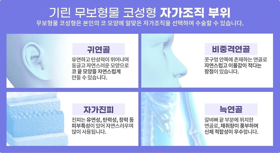 자가연골코성형, 제대로 따져보고 해야 하는 이유 관련 이미지 4