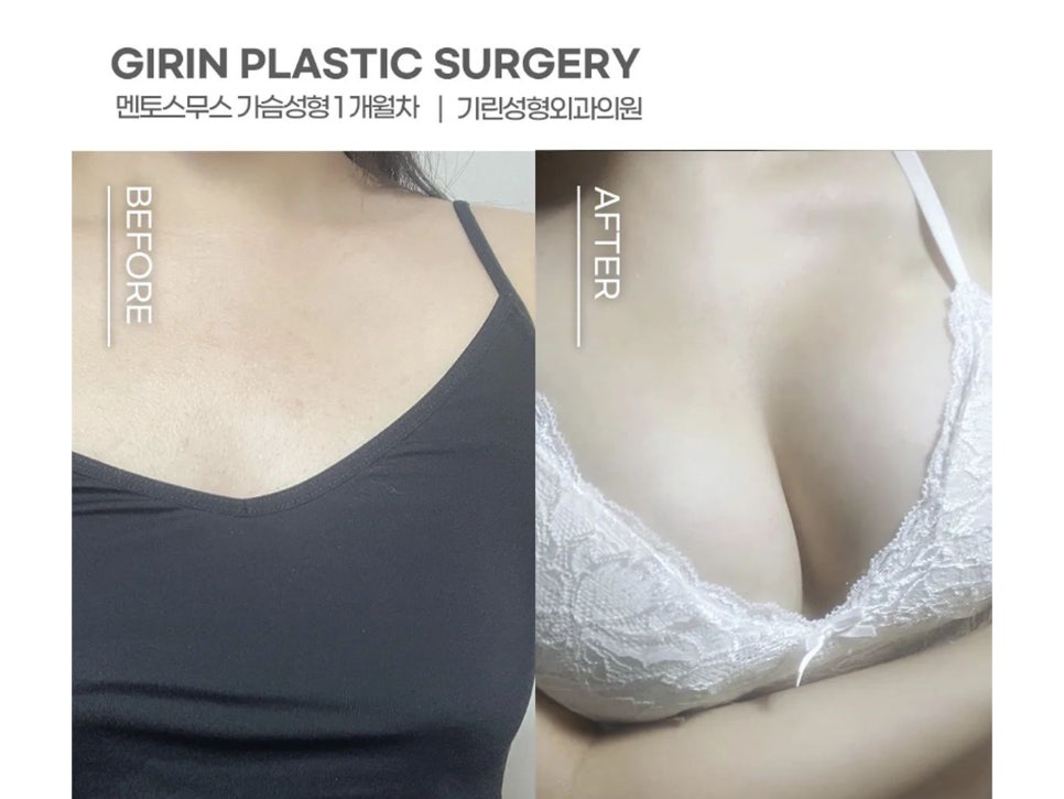 멘토엑스트라 자연스러운 촉감 관련 이미지 13