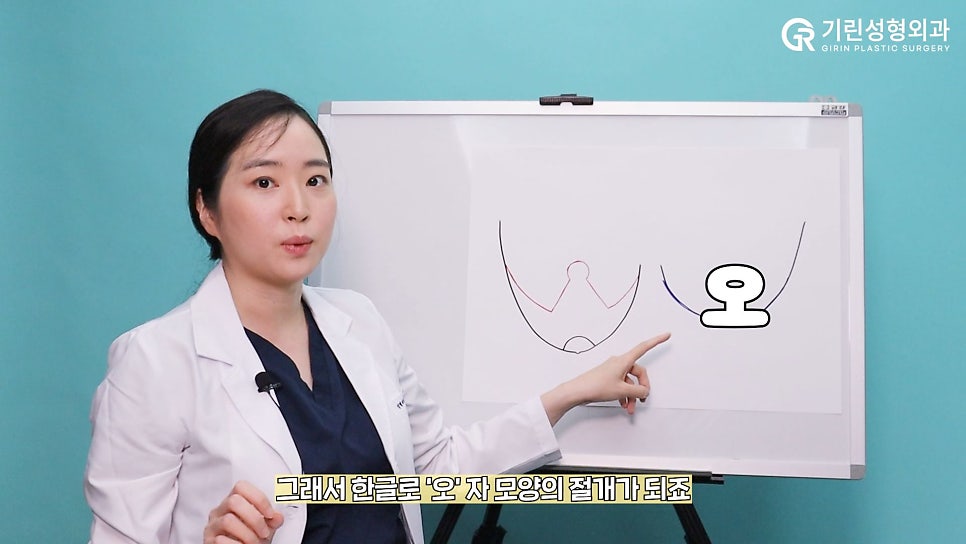 [기린성형외과]가슴거상_처진가슴 자가 진단법 및 수술법 관련 이미지 9