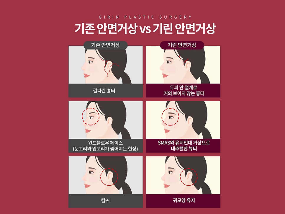 안면거상술잘하는병원 자세히 알아본다면 관련 이미지 14
