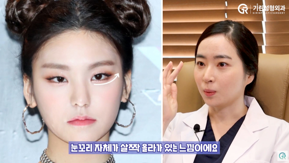 [기린성형외과의원] 무쌍 여자 아이돌의 매력포인트_성형외과 전문의 얼굴분석 관련 이미지 6