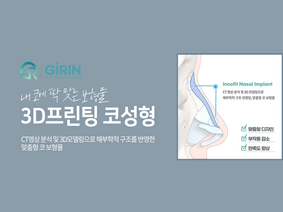 서울코성형 신중하게 정해야 관련 이미지 9