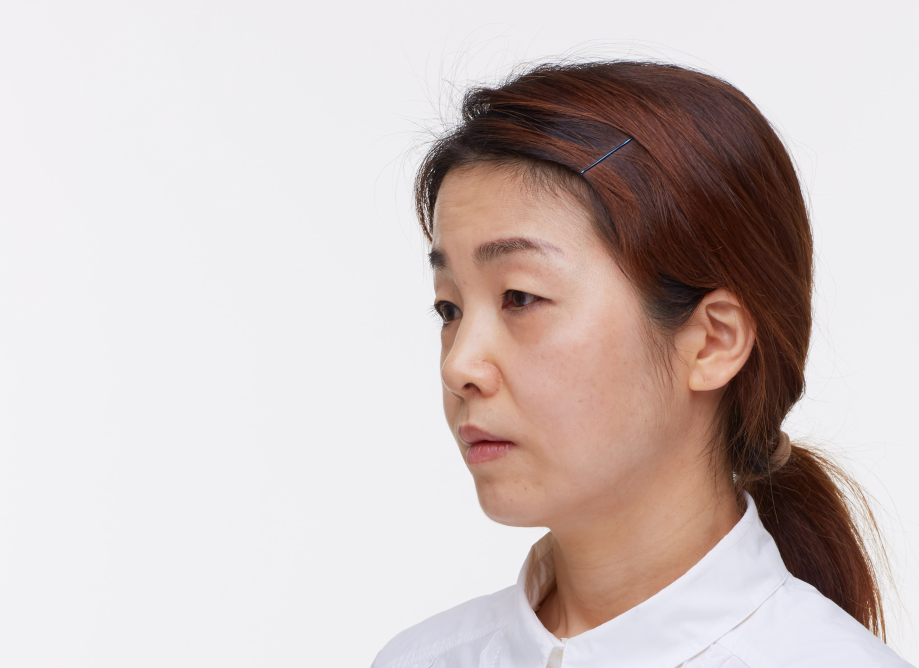 처진눈성형 다시 눈매를 잡아주며 관련 이미지 2