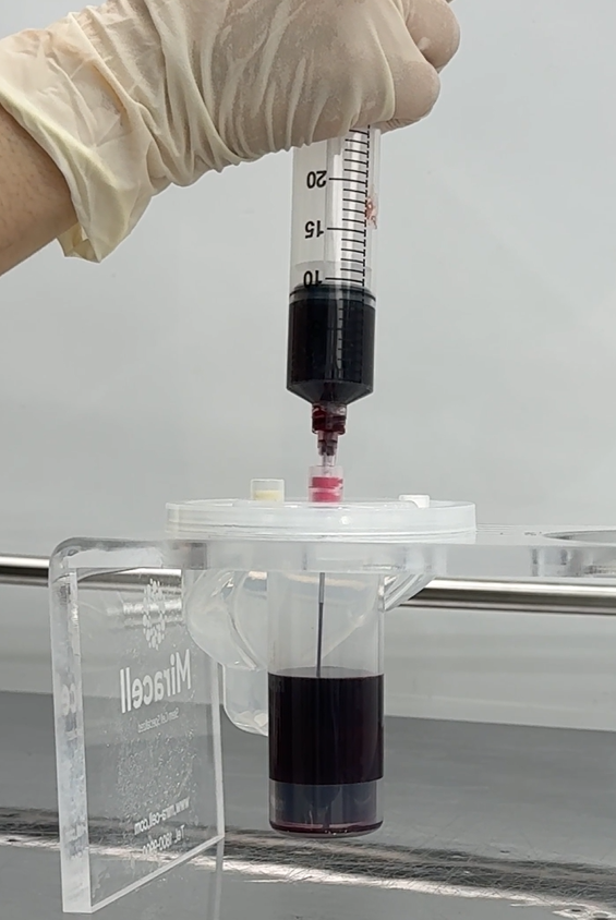 일요일에도 리프팅 가능한 이유 기린성형외과 관련 이미지 9