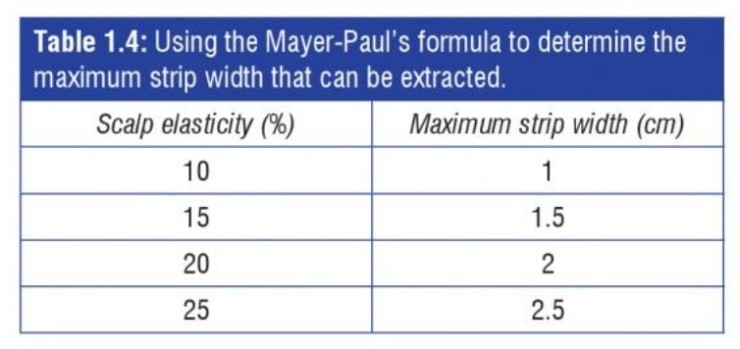 [공유] 이마축소술 두피탄력도 측정? 정말 그렇게 하는게 맞아요? 저는 몇 센티를 줄일 수 있나요? 관련 이미지 7