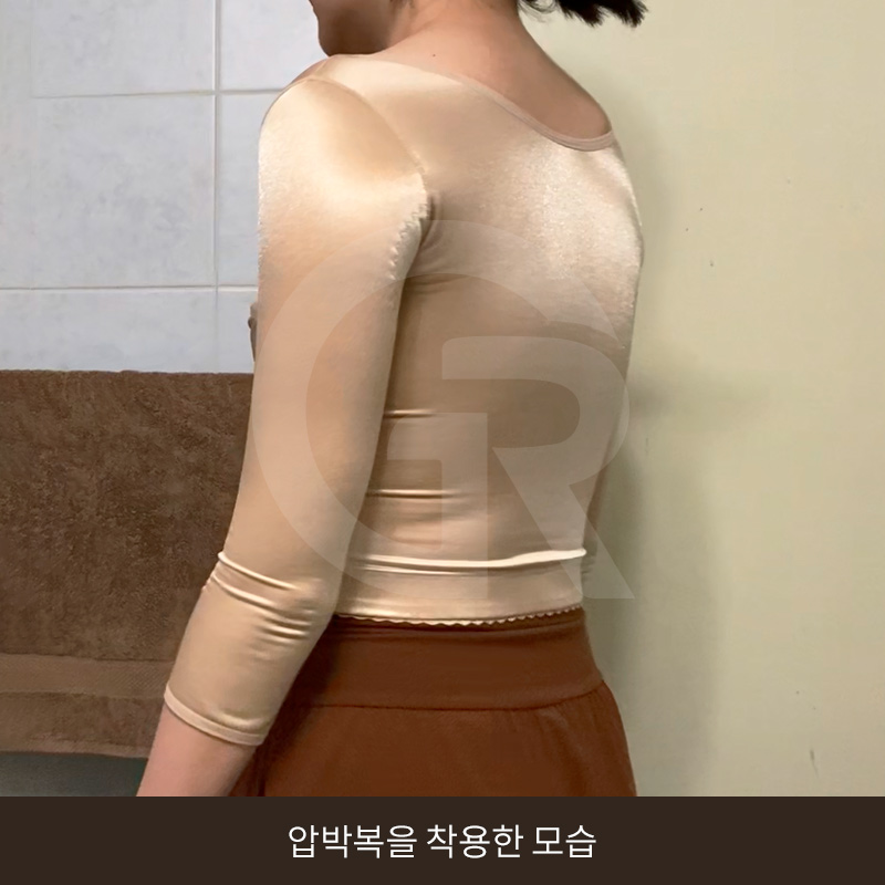 요가로 소용없던 굵은 팔뚝 지방흡입 수술 후기 관련 이미지 10