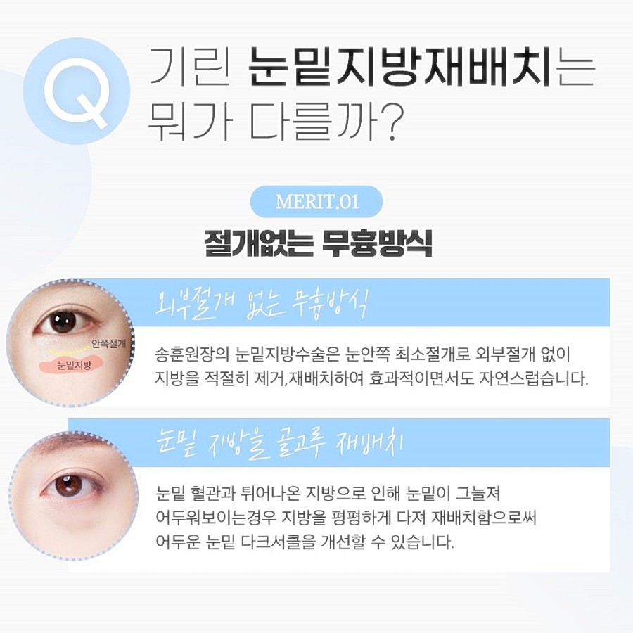 눈밑지방재배치 레이저 vs 수술후, 그동안 걱정했다면 관련 이미지 5