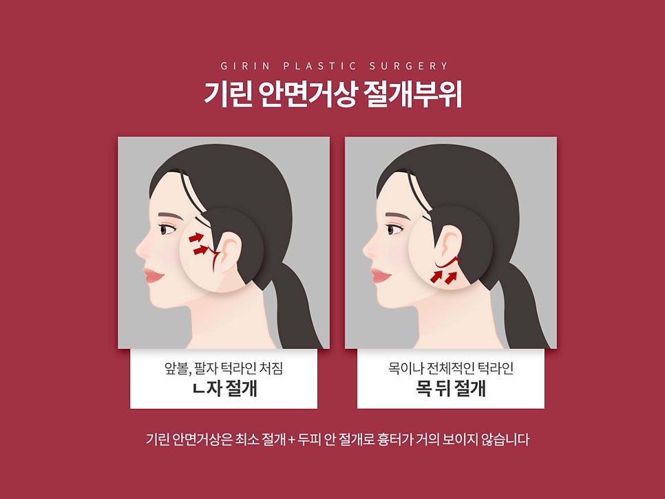 안면거상술잘하는병원 자세히 알아본다면 관련 이미지 13