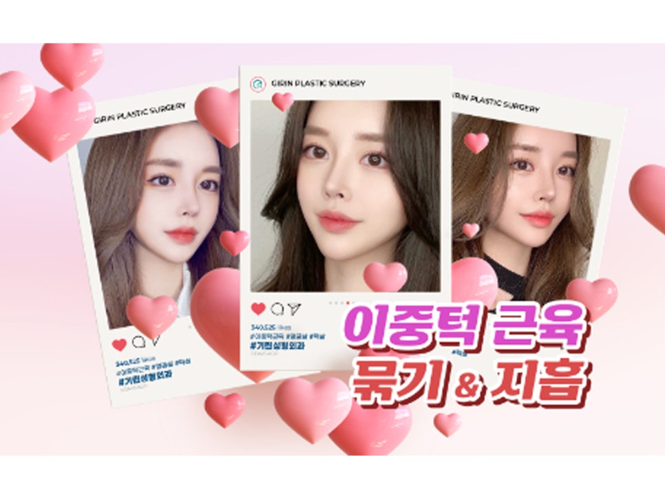 이중턱성형 차이가 궁금하다면 관련 이미지 2