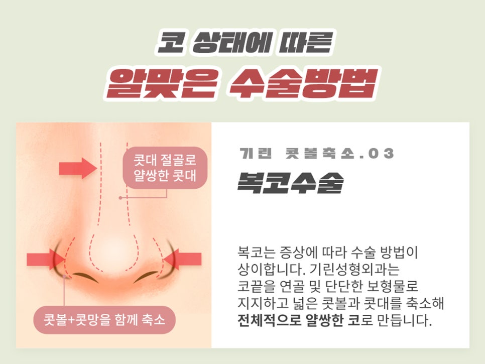 복코수술후기 제대로 찾아야 하는 이유는 관련 이미지 10