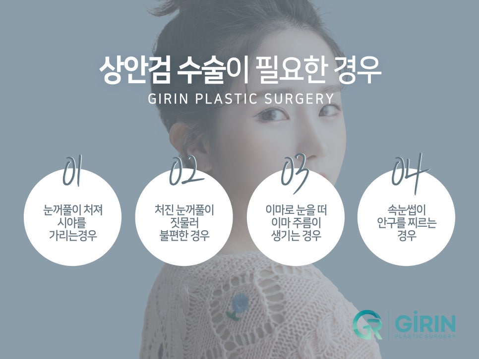 중년눈성형잘하는곳 찾았다면 관련 이미지 6