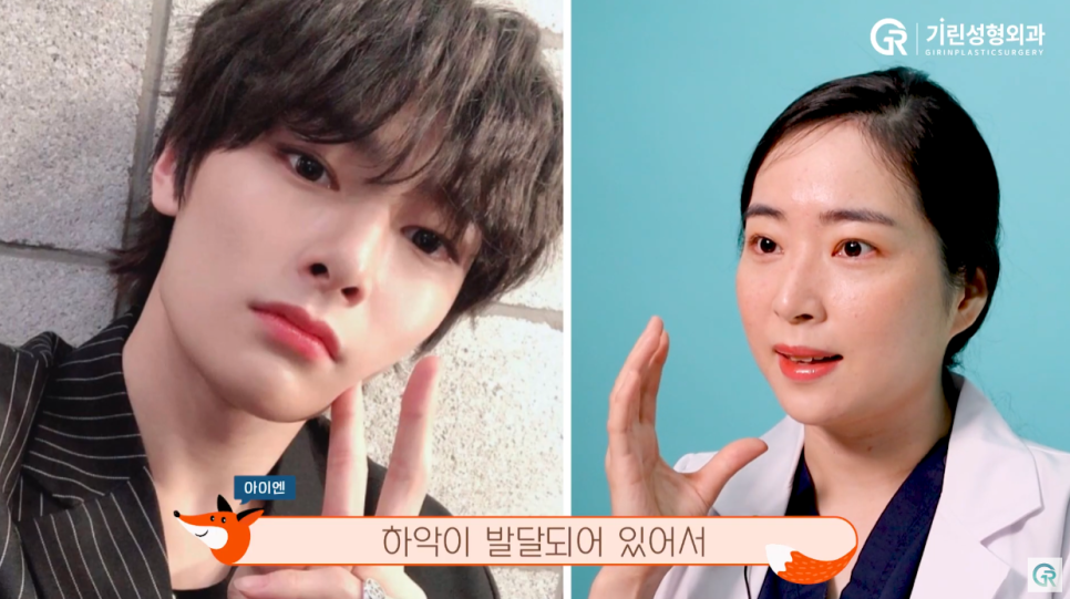 [기린성형외과의원] 또렷하고 개성있는 사막여우상 남돌_성형외과 전문의 얼굴분석 관련 이미지 8