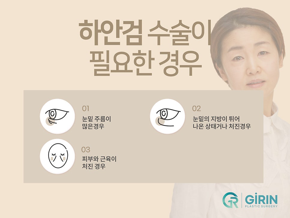 처진눈성형 다시 눈매를 잡아주며 관련 이미지 11