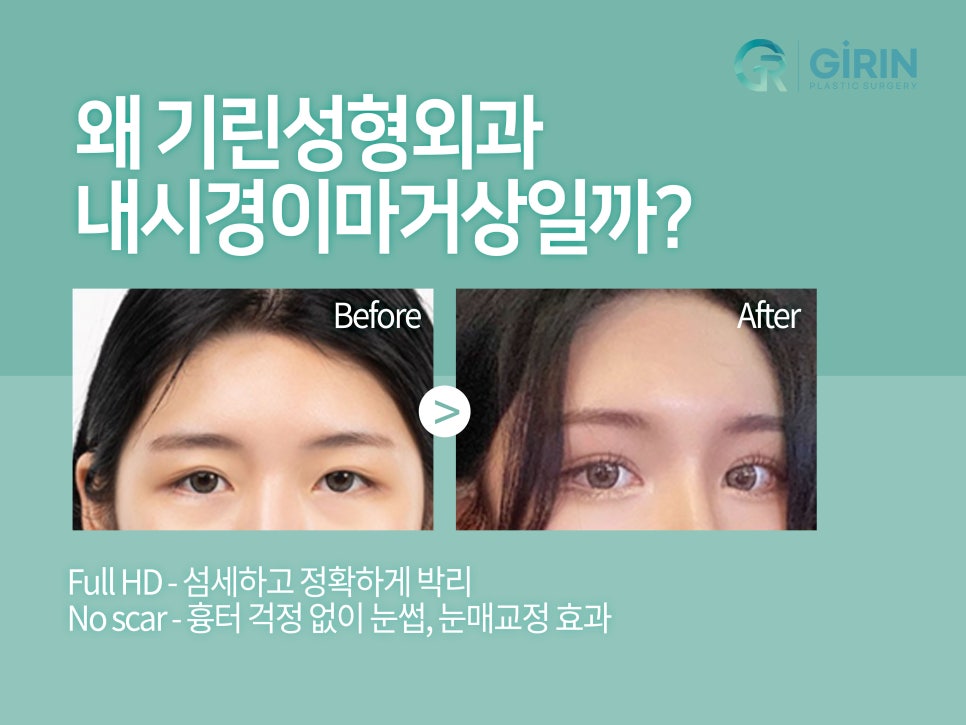 이마거상술효과 확실히 보려면 관련 이미지 4