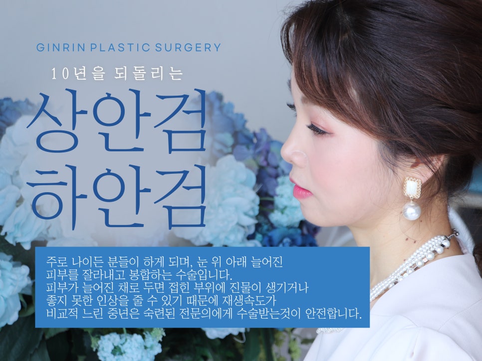 중년눈성형 우아하게 잡아주며 관련 이미지 4