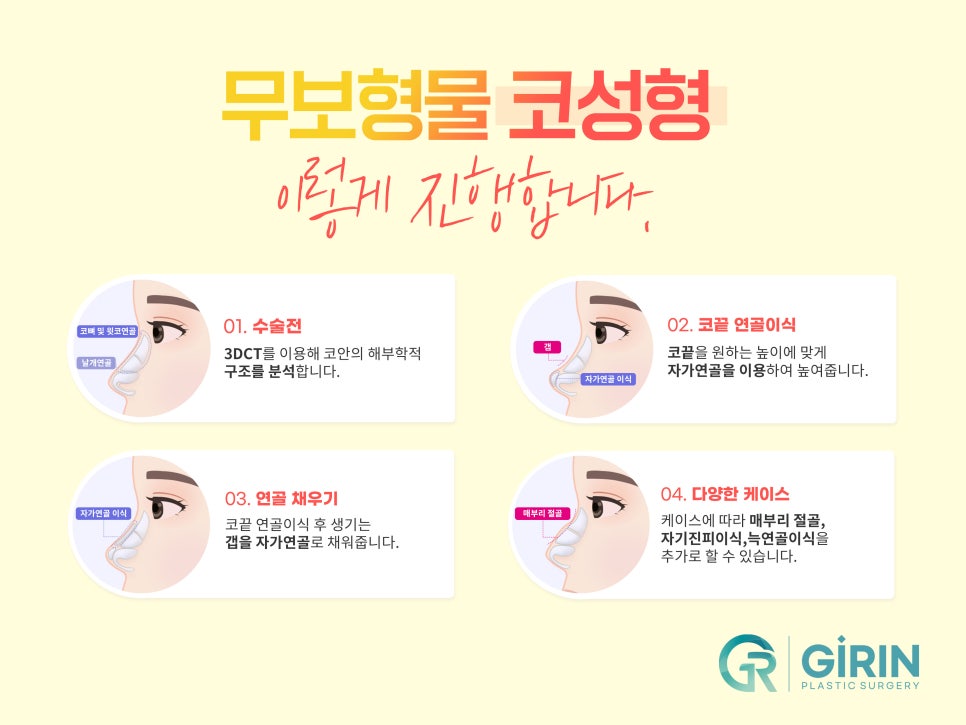 논현성형외과 낮은 콧대 고민은 관련 이미지 7