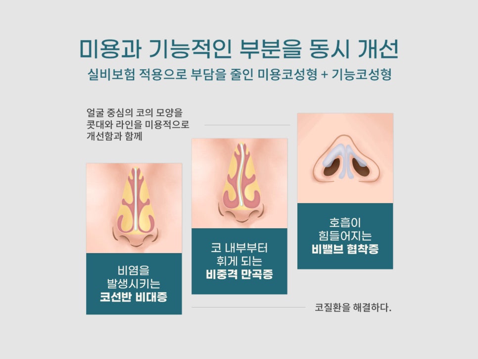 기능코수술 불편함을 해결하자 관련 이미지 2