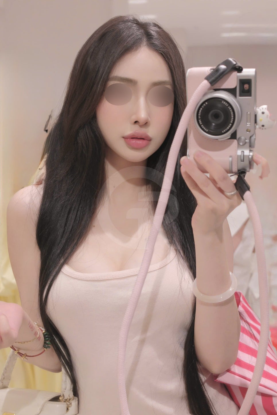 연조직윤곽술, 비대칭을 최소화하는 방법 관련 이미지 6