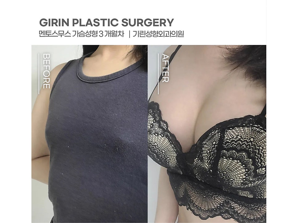 멘토엑스트라 자연스러운 촉감 관련 이미지 9