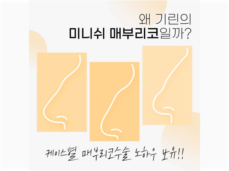 매부리코수술후기 올바른 라인으로 관련 이미지 5