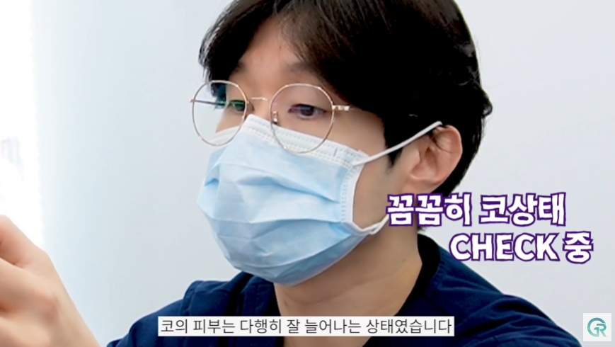 [기린성형외과] 짧고, 들린 코 탈출!_코성형 수술일지 관련 이미지 5