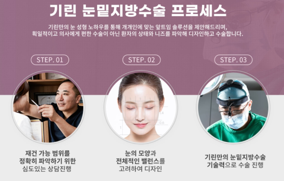 눈밑지방제거수술 하안검 선택의 폭이 넓어졌어요! 관련 이미지 9