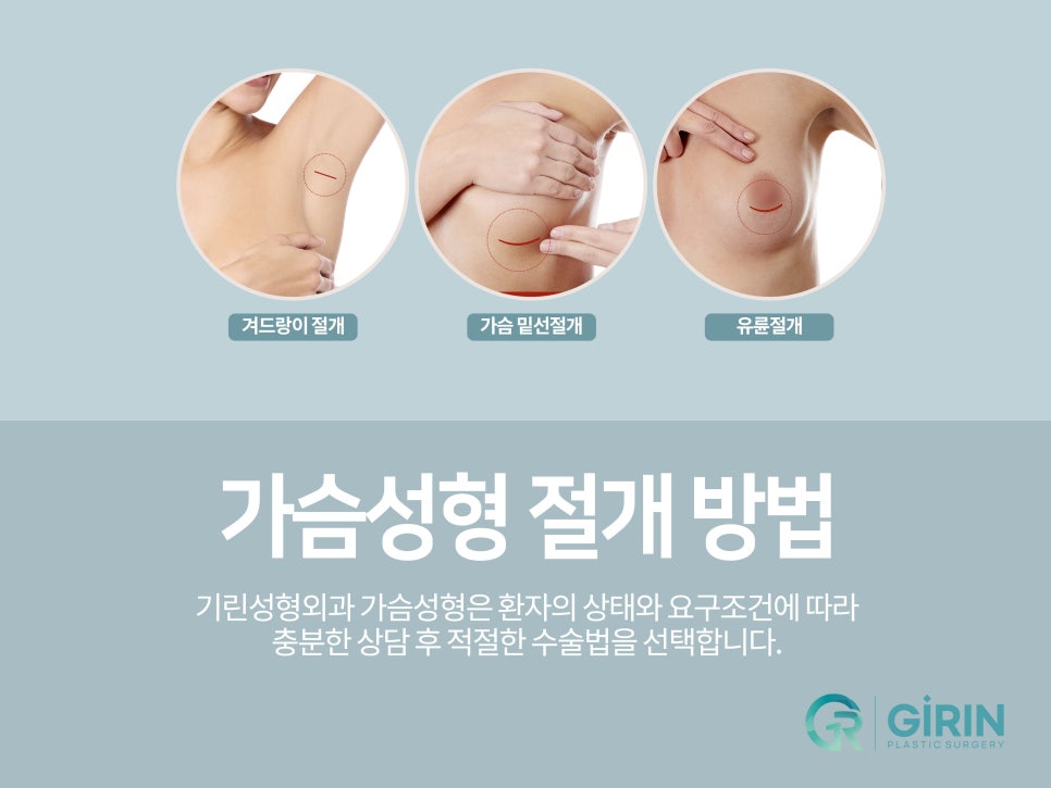 가슴성형 촉감도 중요하니까 관련 이미지 7