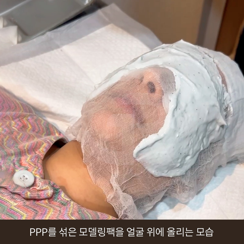 탈모 고민 두피 줄기세포 치료, 가격이 다른 이유는? 관련 이미지 15