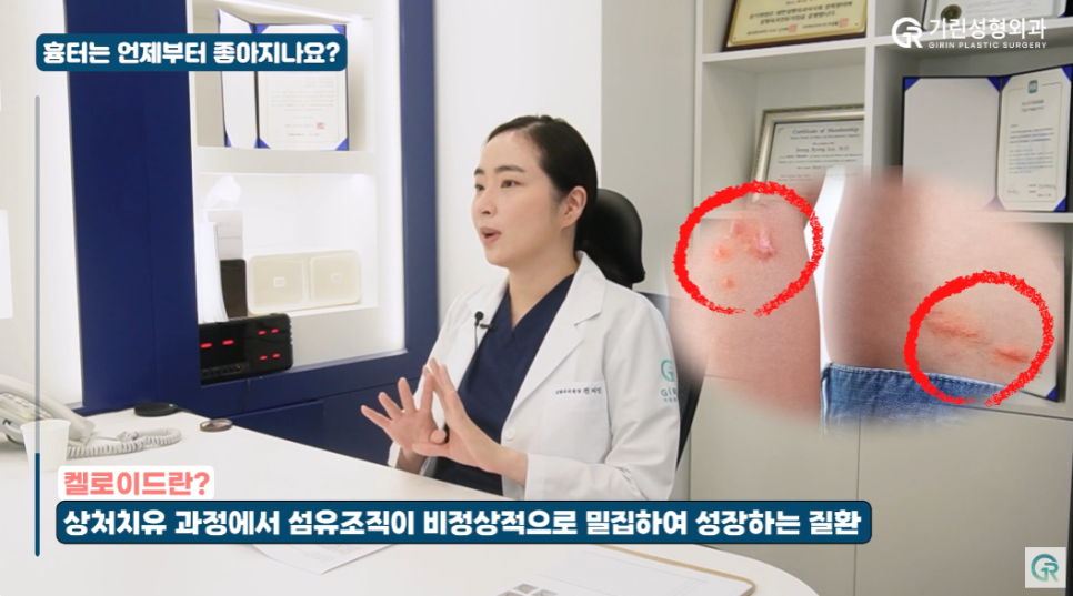 [기린성형외과] 성형의 꽃은 가슴?_가슴거상수술 부작용 주의사항 Q&A 관련 이미지 5