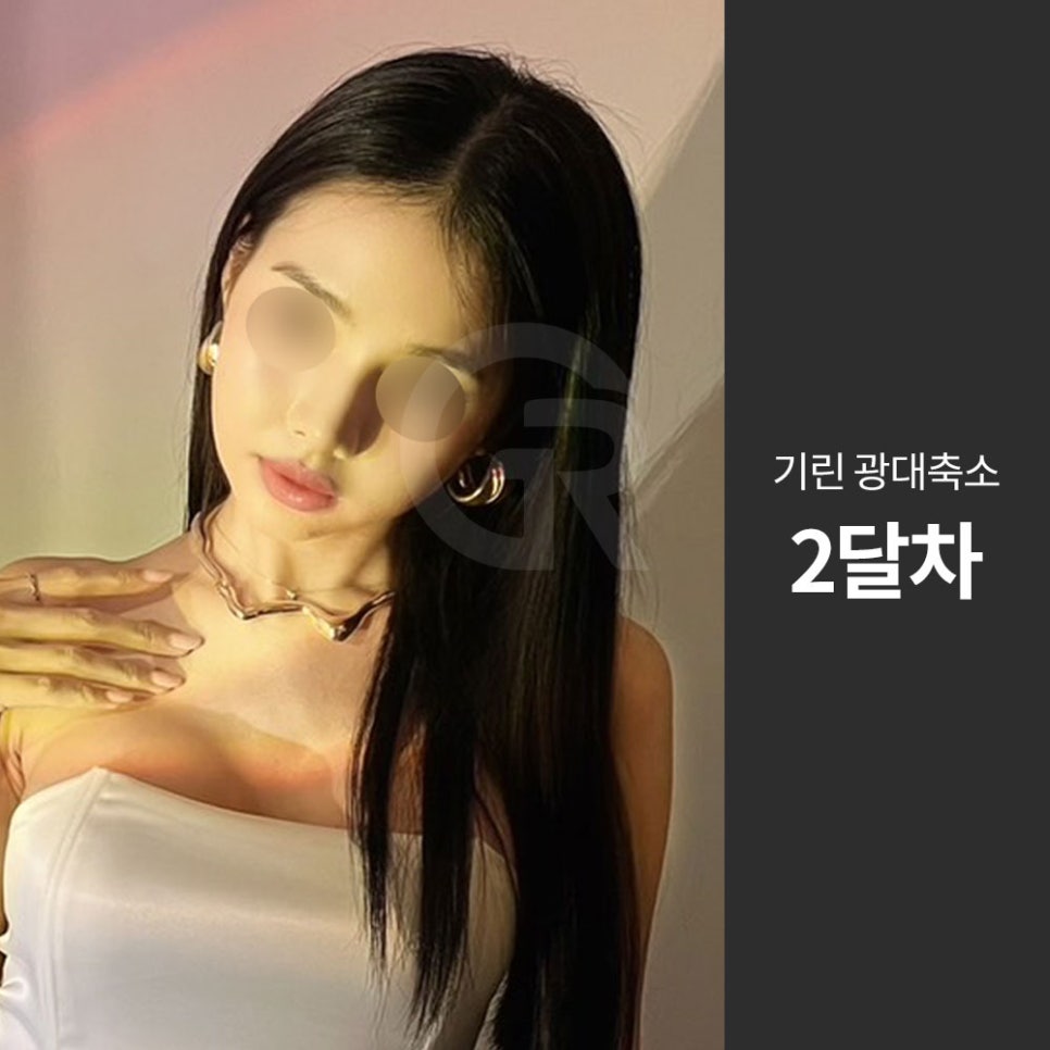 광대가 큰 얼굴, 축소술은 인상을 조율하는 기준점입니다 관련 이미지 5