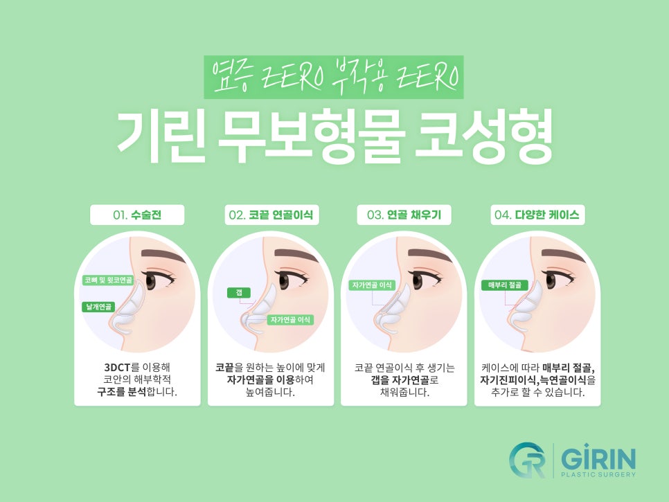 강남코재수술 원인 생각하여 관련 이미지 6