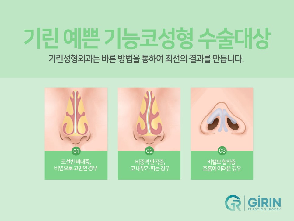 비염코성형 실비 가능성 있기에 관련 이미지 3