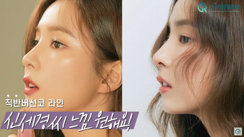 [기린성형외과의원] 코성형 전 코필러 하셨나요?_작은 코성형 수술일지 관련 이미지 3