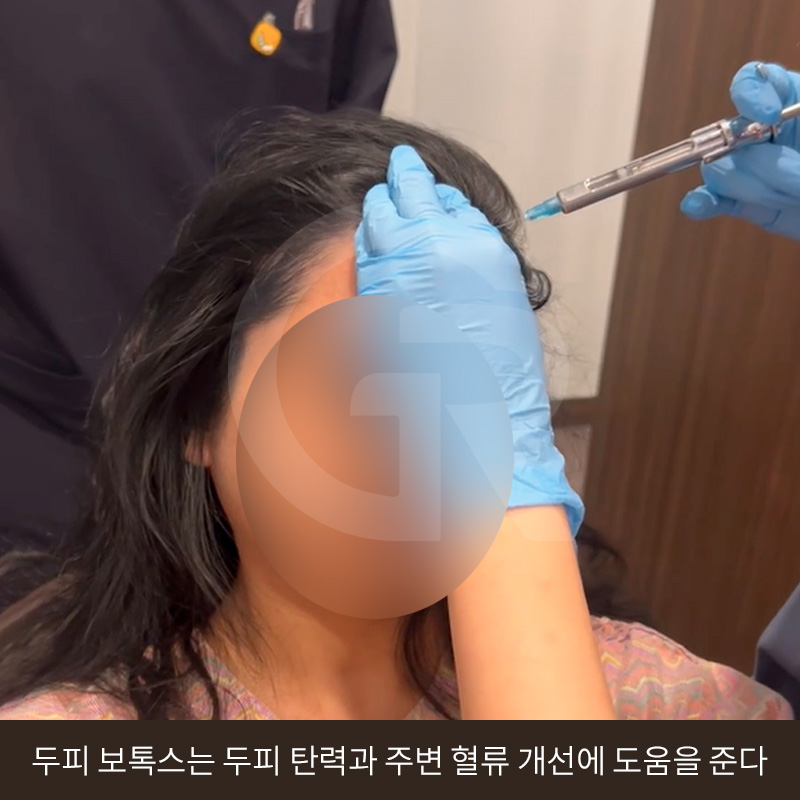 탈모 고민 두피 줄기세포 치료, 가격이 다른 이유는? 관련 이미지 10