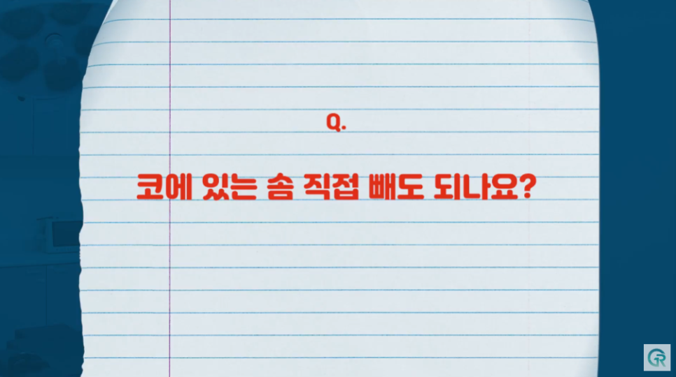 [기린성형외과] "딱 한 개비도 안될까요...?"_코성형 주의사항 Q&A 관련 이미지 8