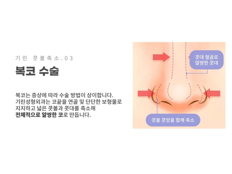 서울코수술 생김새에 따라 다르게 관련 이미지 12