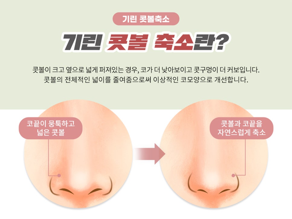 복코수술후기 제대로 찾아야 하는 이유는 관련 이미지 2