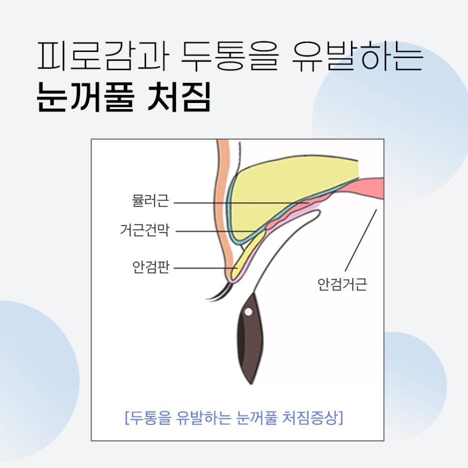 기린성형외과 안티에이징 눈성형 특별한 무엇? 관련 이미지 3
